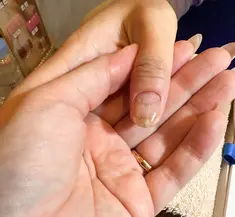 即見た目改善 nail2