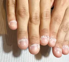 即見た目改善 nail8