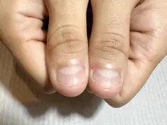 即見た目改善 nail6