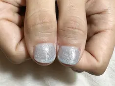 即見た目改善 nail11