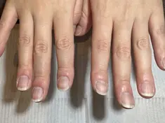 即見た目改善 nail12