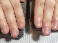 即見た目改善 nail14