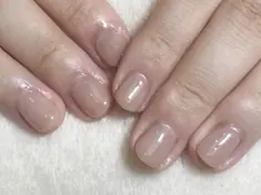 即見た目改善 nail15