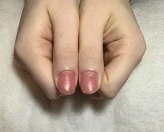 即見た目改善 nail31