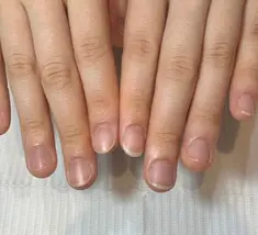 即見た目改善 nail29