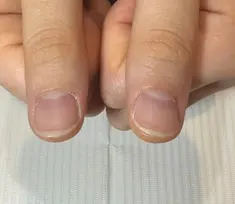 即見た目改善 nail30