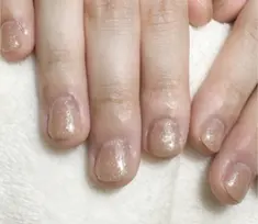 即見た目改善 nail19