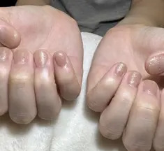 即見た目改善 nail18