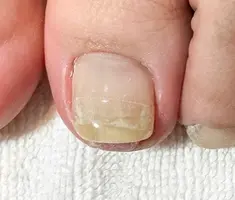 即見た目改善 nail25