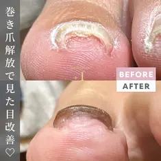 即見た目改善 nail26