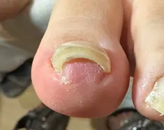 即見た目改善 nail27