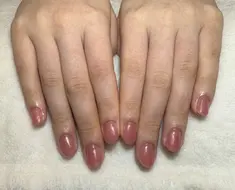 即見た目改善 nail32